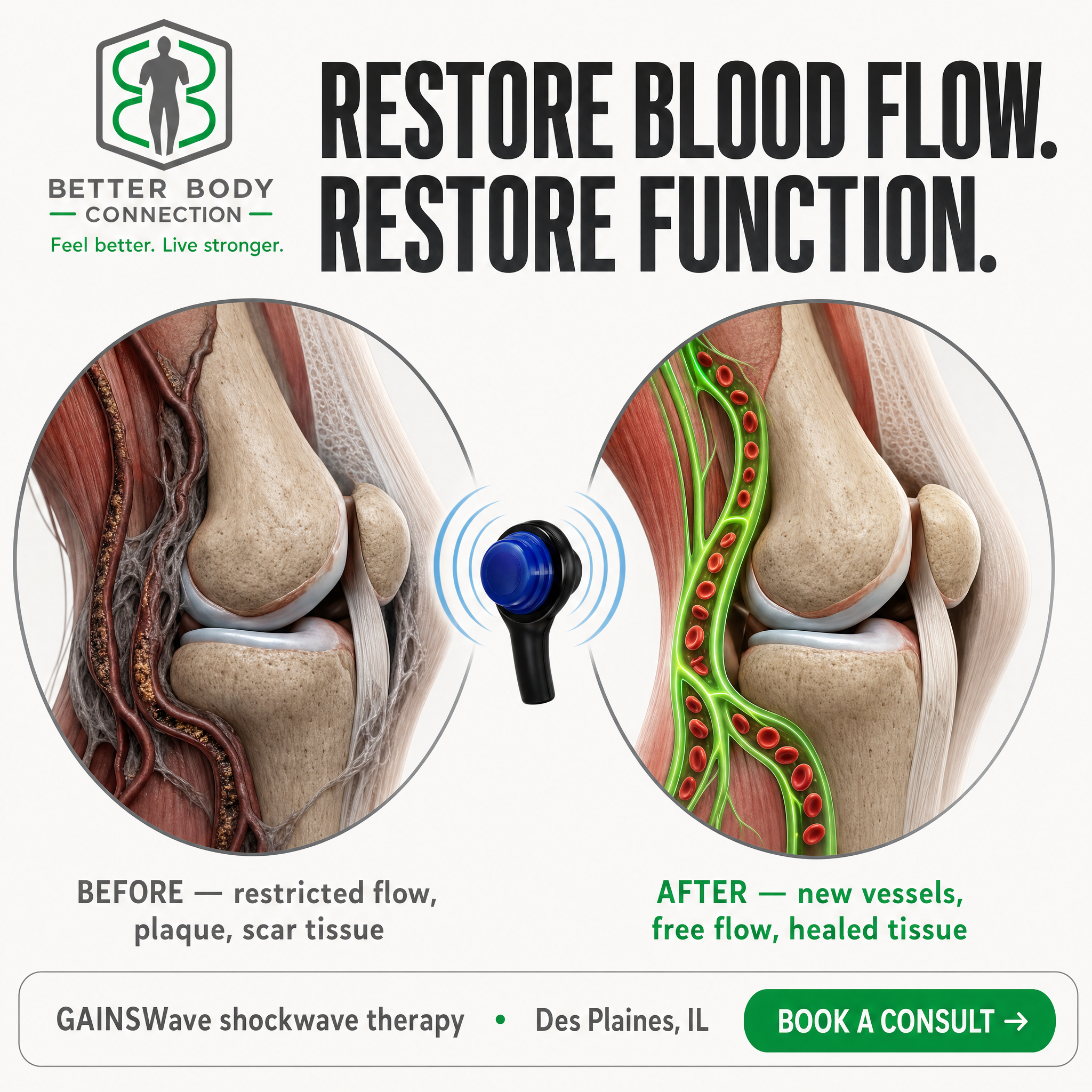 Better Body Connection Facebook ad: Des Plaines We Got You!
