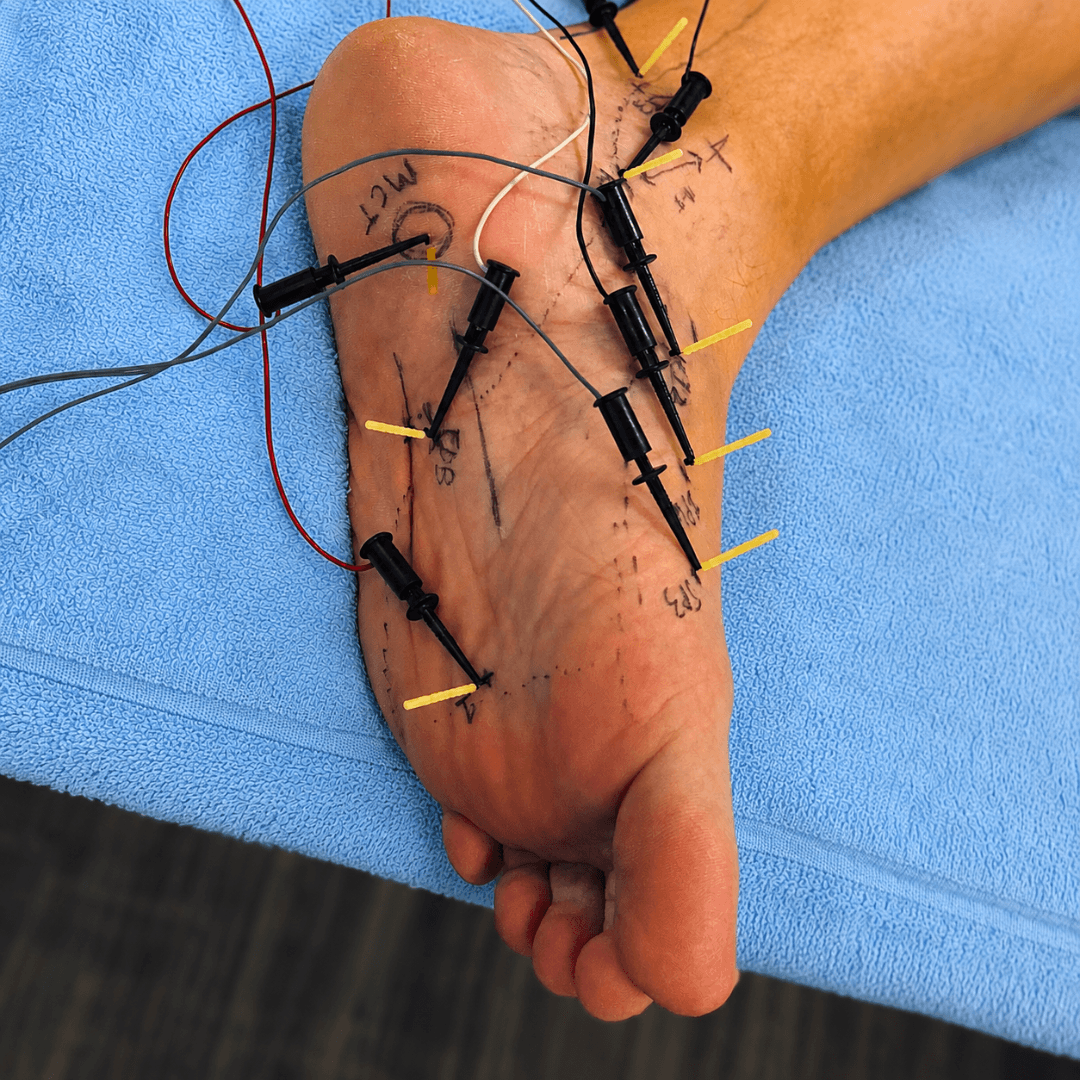 Rachel Miller Facebook ad: Foot Pain? It's Trapped Fascia