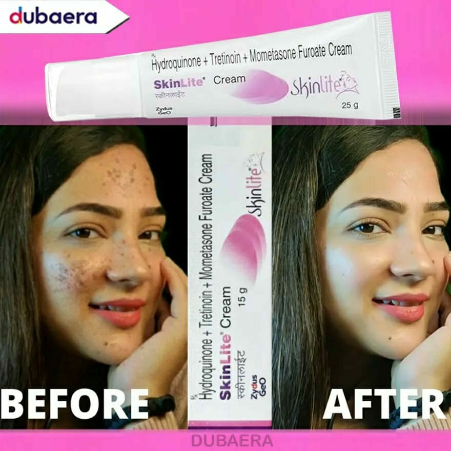 Beauty Fashion's Stor's Facebook ad: كريم سكينليت للبقع الداكنة