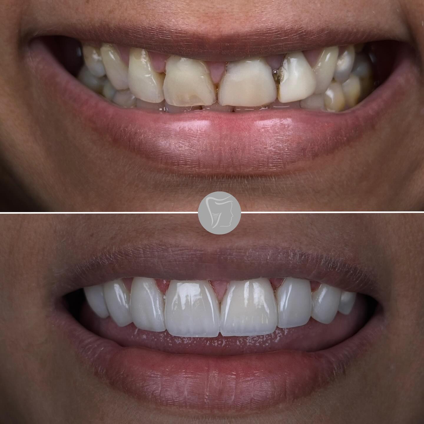 clinicanapoleao Facebook ad: Confira o antes e depois deste paciente que…