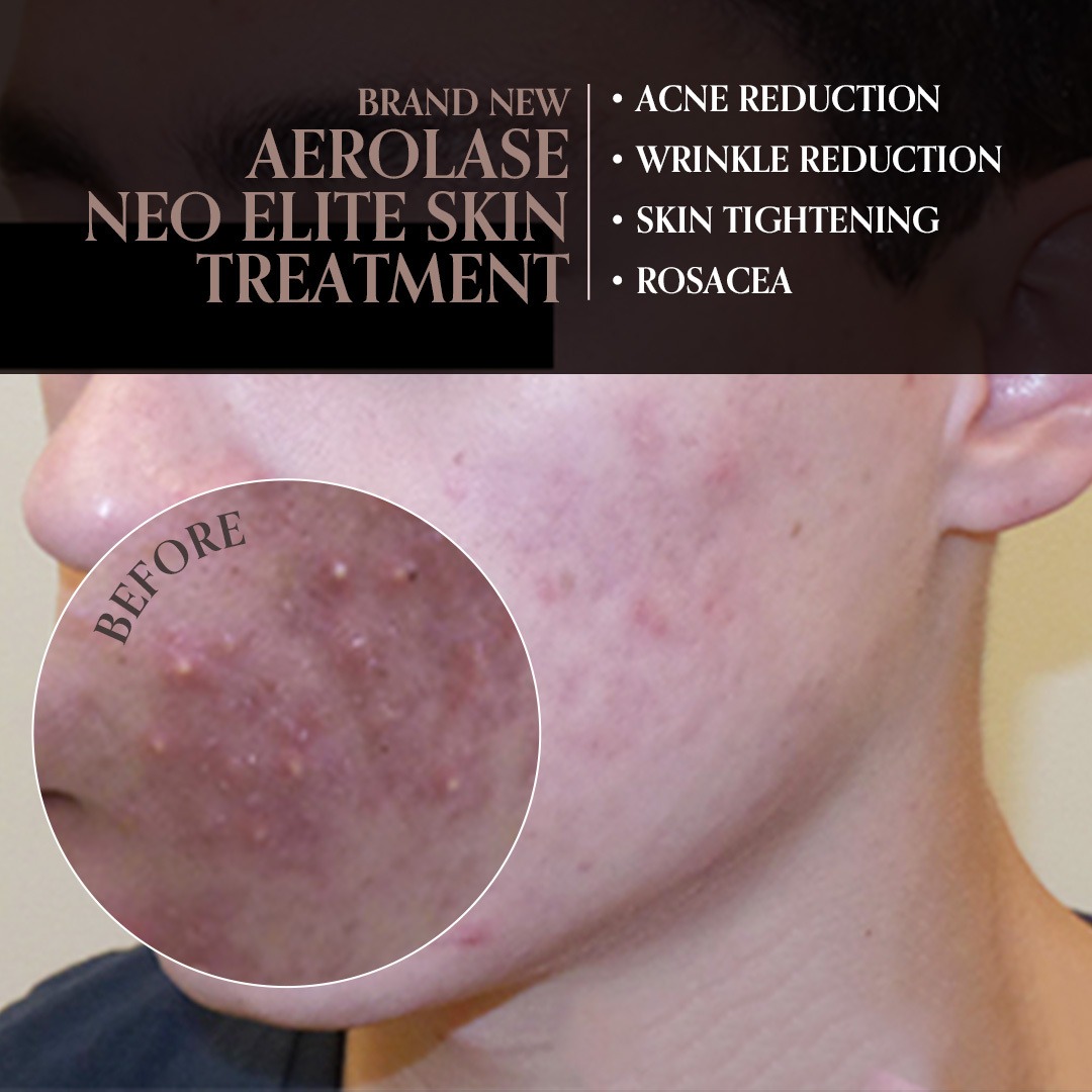 The Skin Company BA Facebook ad