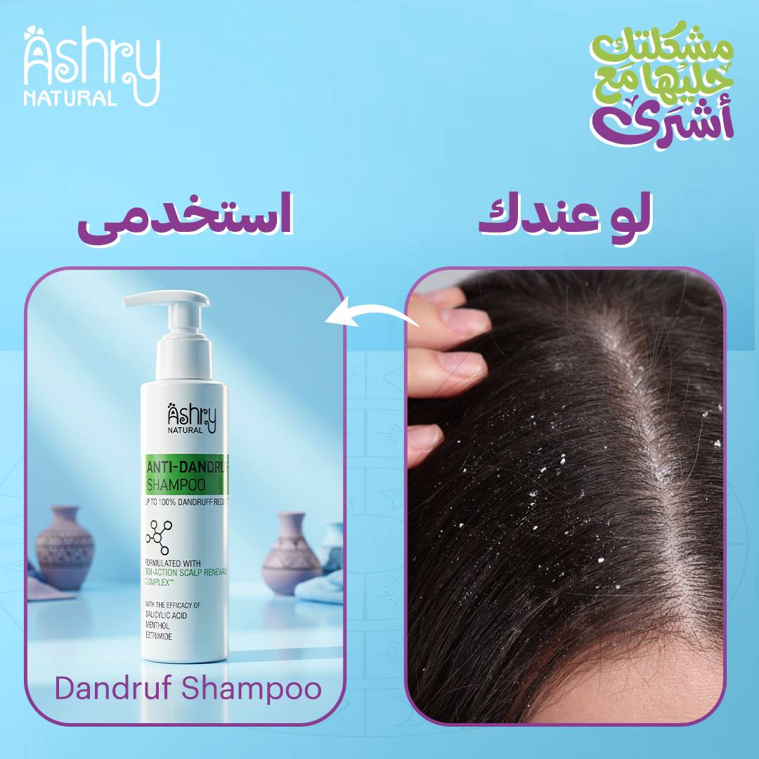 Ashry Natural Facebook ad: عندك قشرة؟ هيشان؟ تساقط؟ جلد وزة؟ شفايف جافة؟…