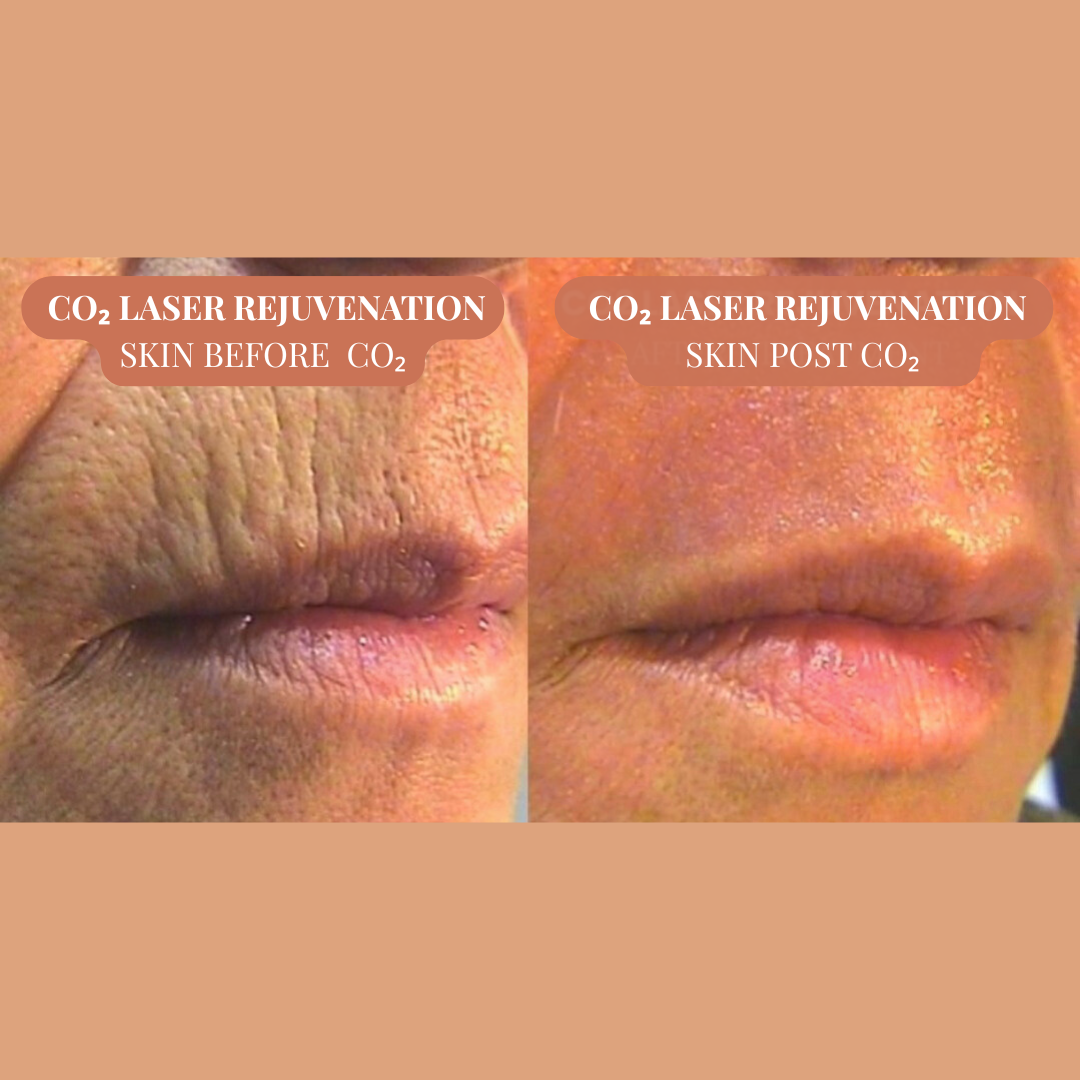 Laura Haig Aesthetics Facebook ad