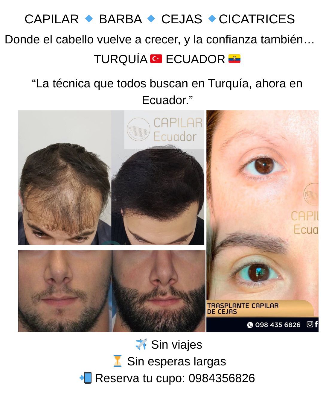 Capilar Ecuador Facebook ad: Chatea con nosotros