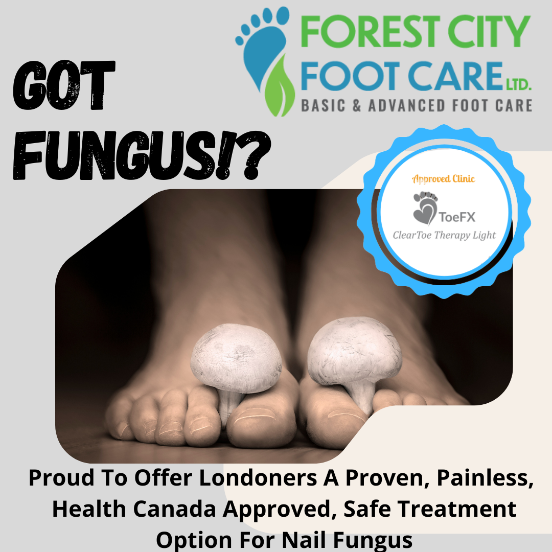 Forest City Foot Care Ltd. Facebook ad: Advanced Foot Care Nurse.