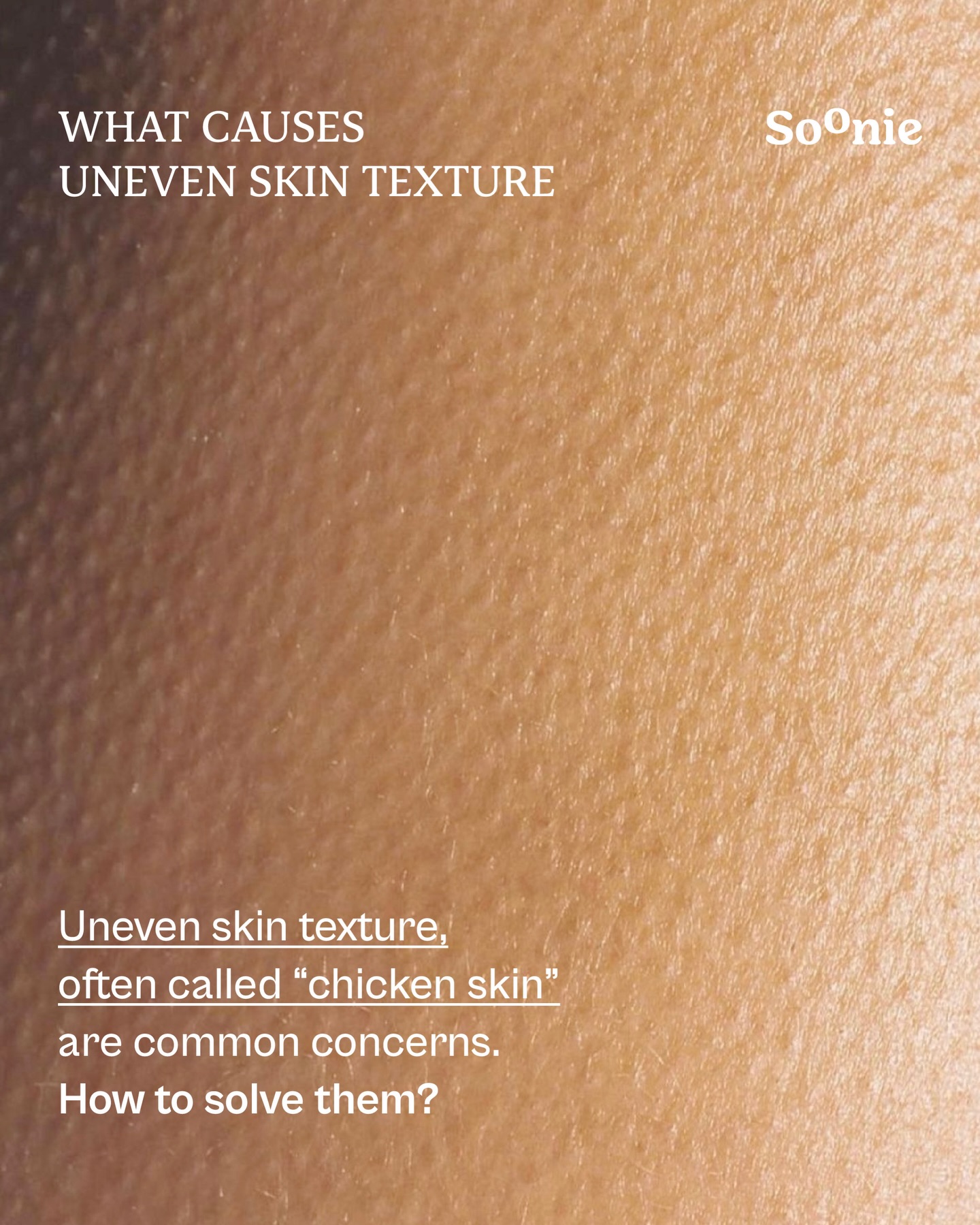 Soonie Facebook ad: Uneven skin texture a.k.a chicken skin?