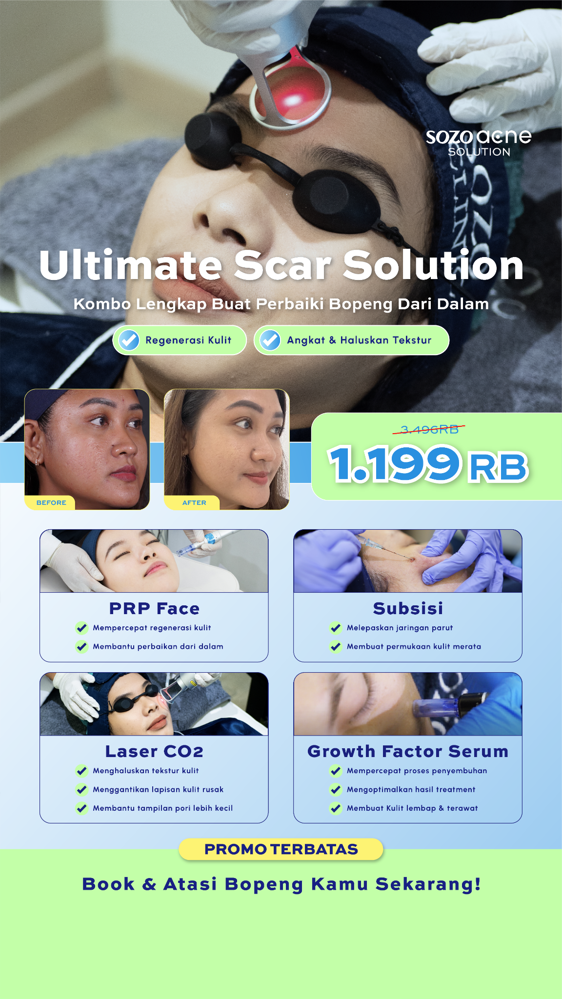 Sozo Acne Facebook ad