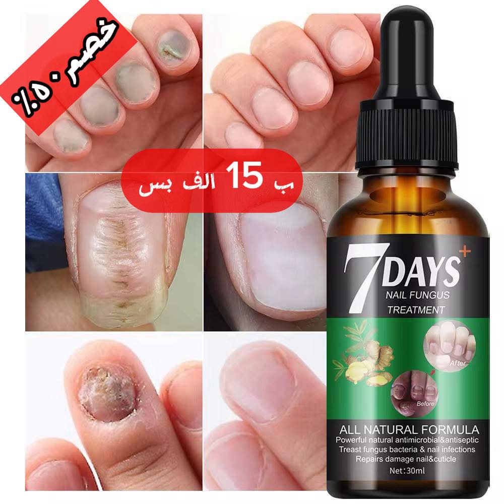 العالمي للأعشاب والطب البديل Facebook ad: عرض لمدة اسبوع ( خصم ٥٠٪ ) بـ…