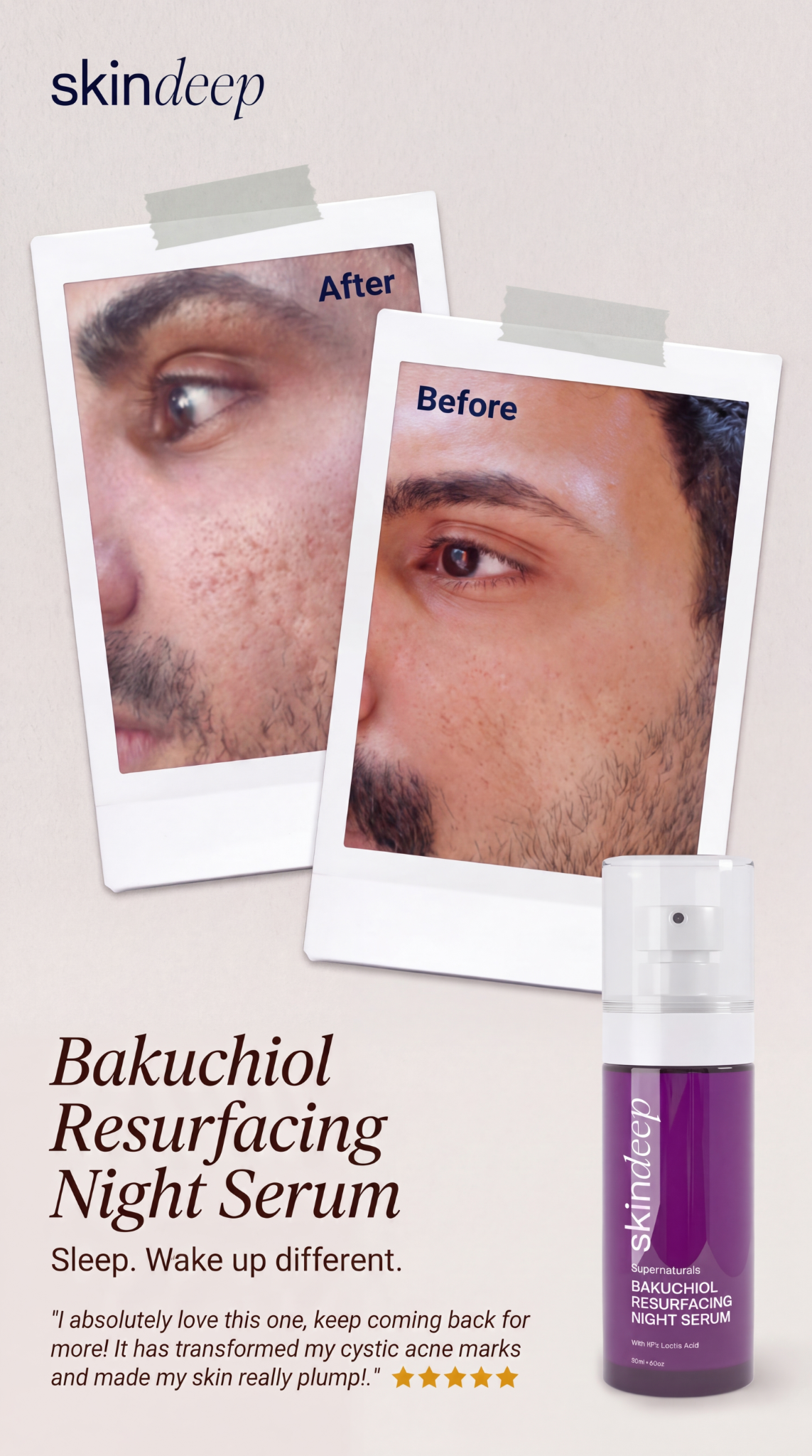 Skin Deep Facebook ad