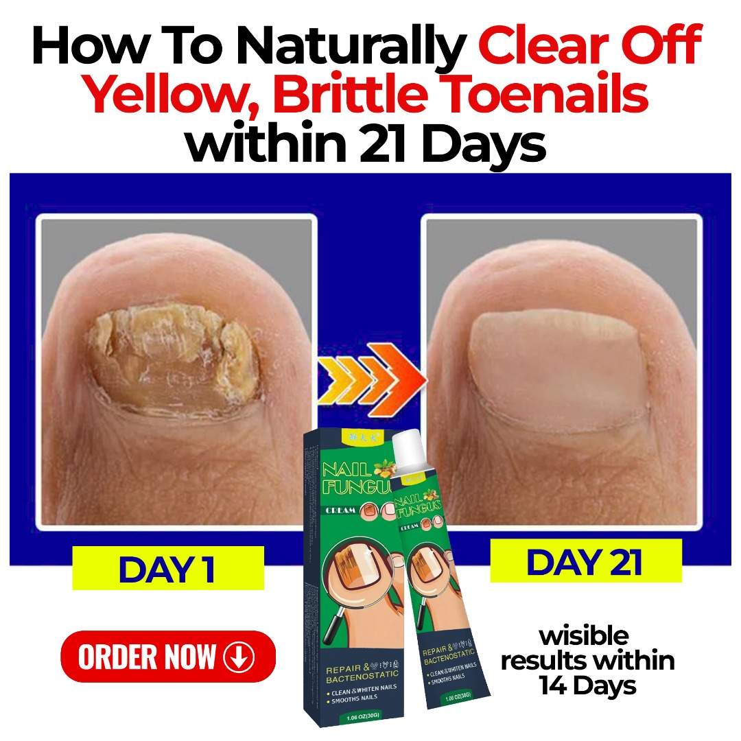 Nail Fungus Treatment Facebook ad: Fast, Visible Resultsfor Stubborn Nail Fungus.