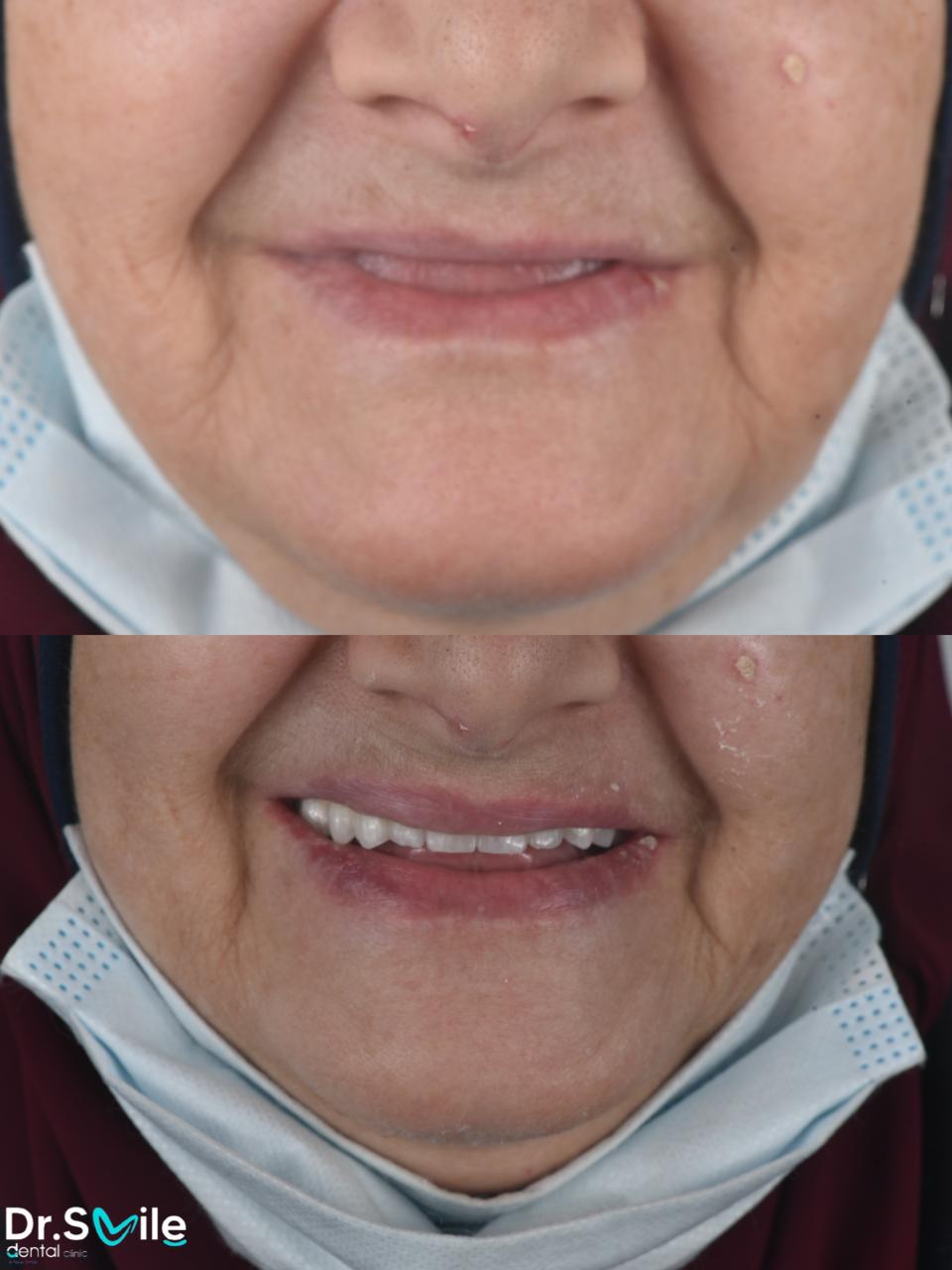 Dr.Smile Dental Clinic - لزراعة وتجميل الأسنان Facebook ad