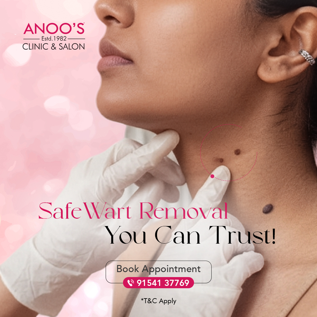 Anoo's Facebook ad