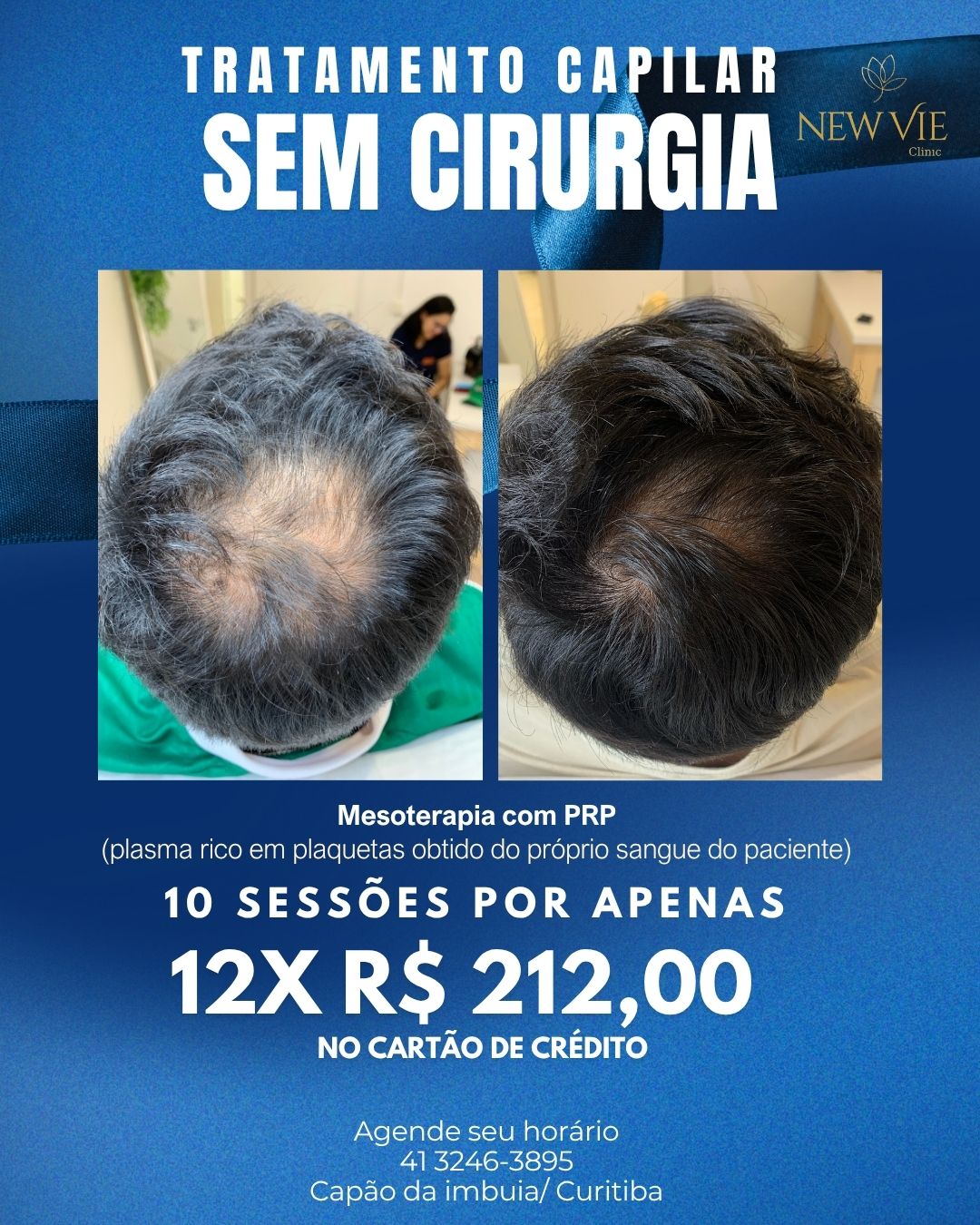 NewVie Clinic Facebook ad