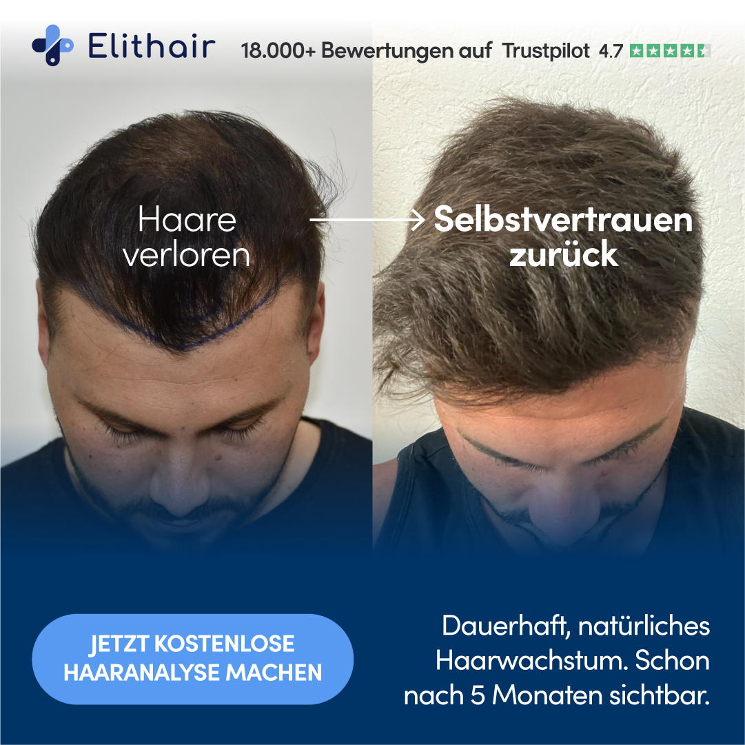 Elithair Facebook ad: Jetzt kostenlose Haaranalyse