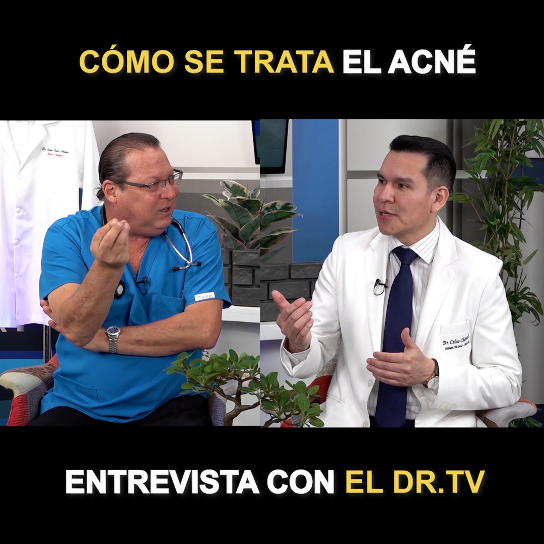 Acné Clínica Trigoso Facebook ad: Cómo Curar el Acné