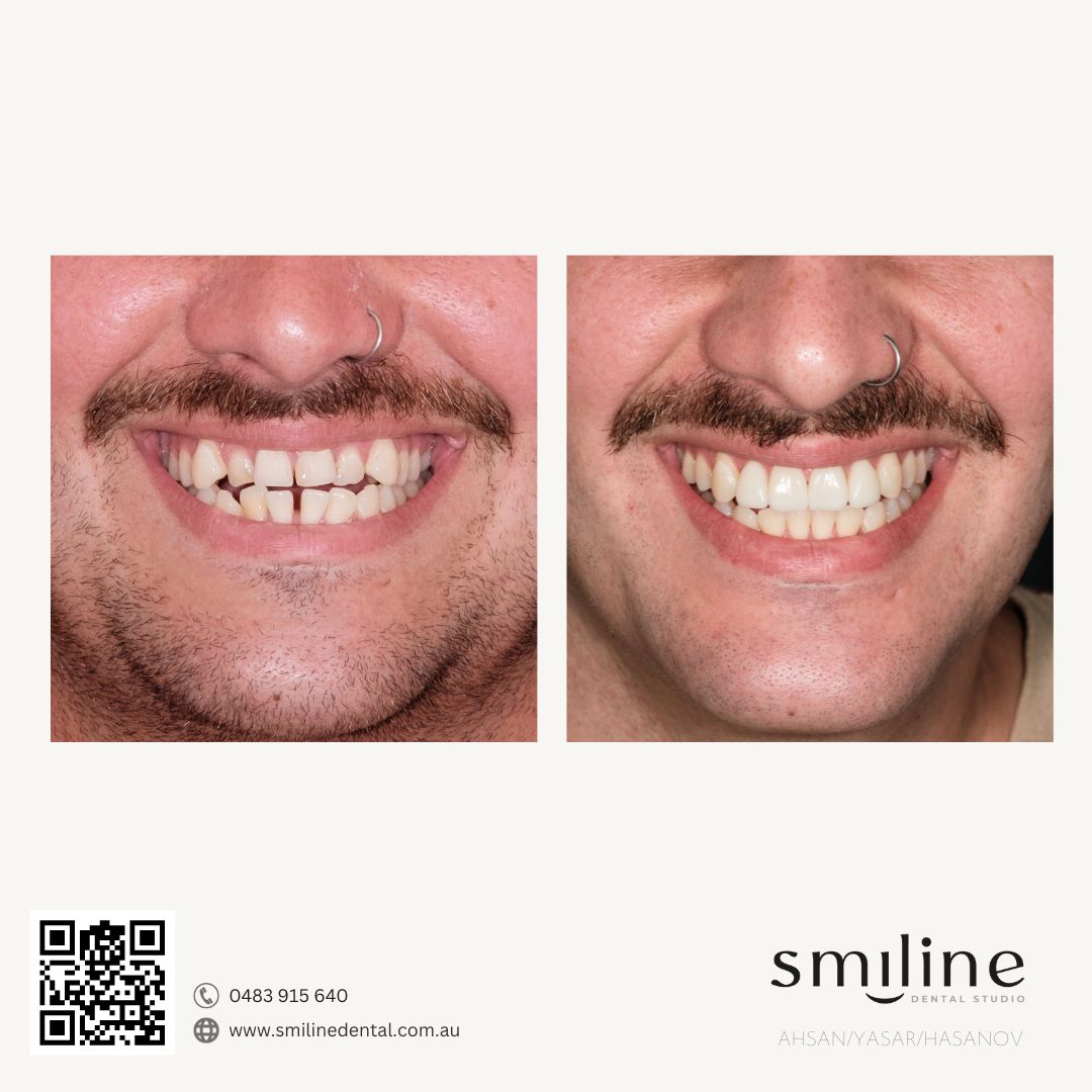Smiline Dental Facebook ad