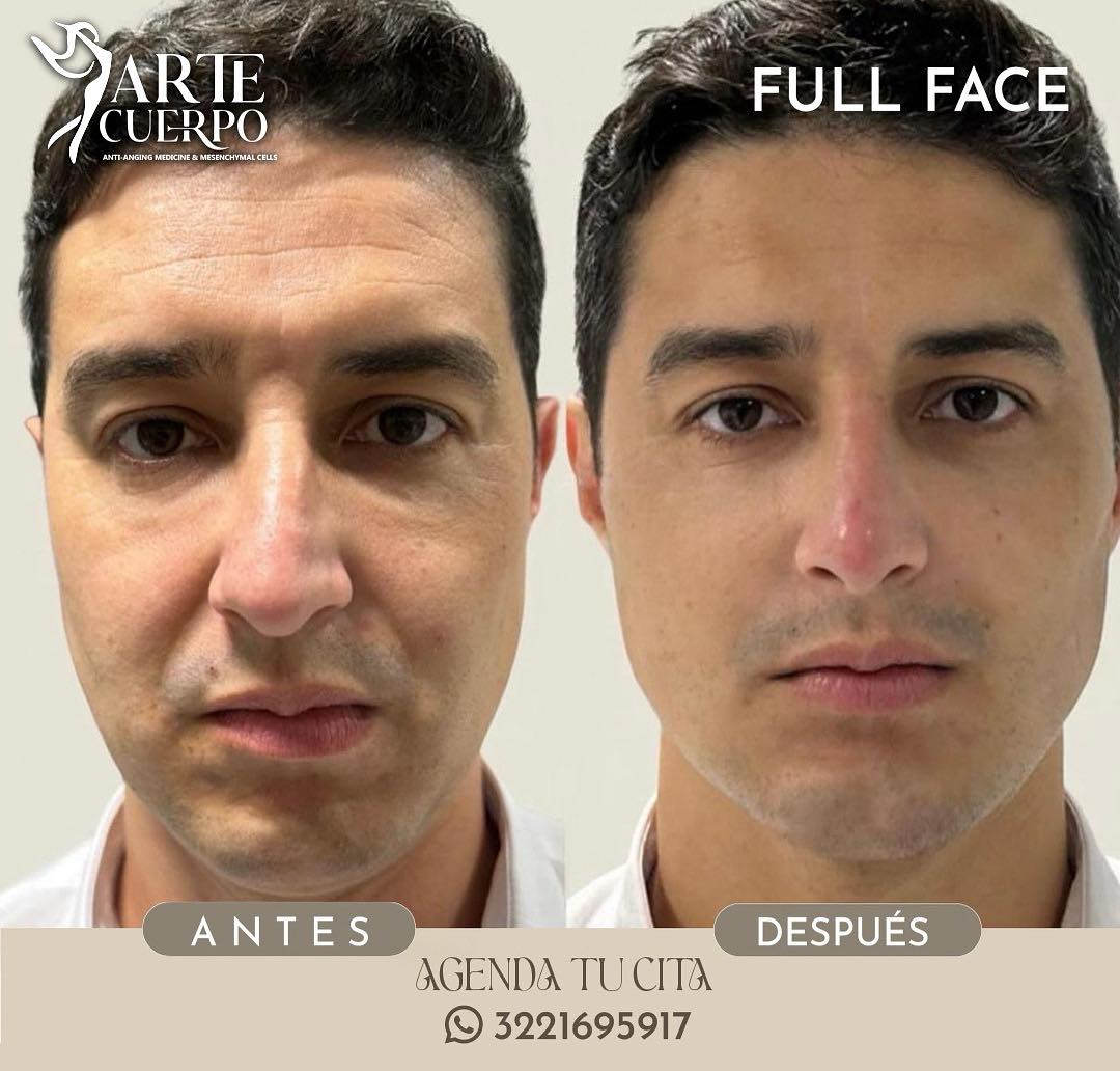 Clinica spa arte cuerpo  Facebook ad