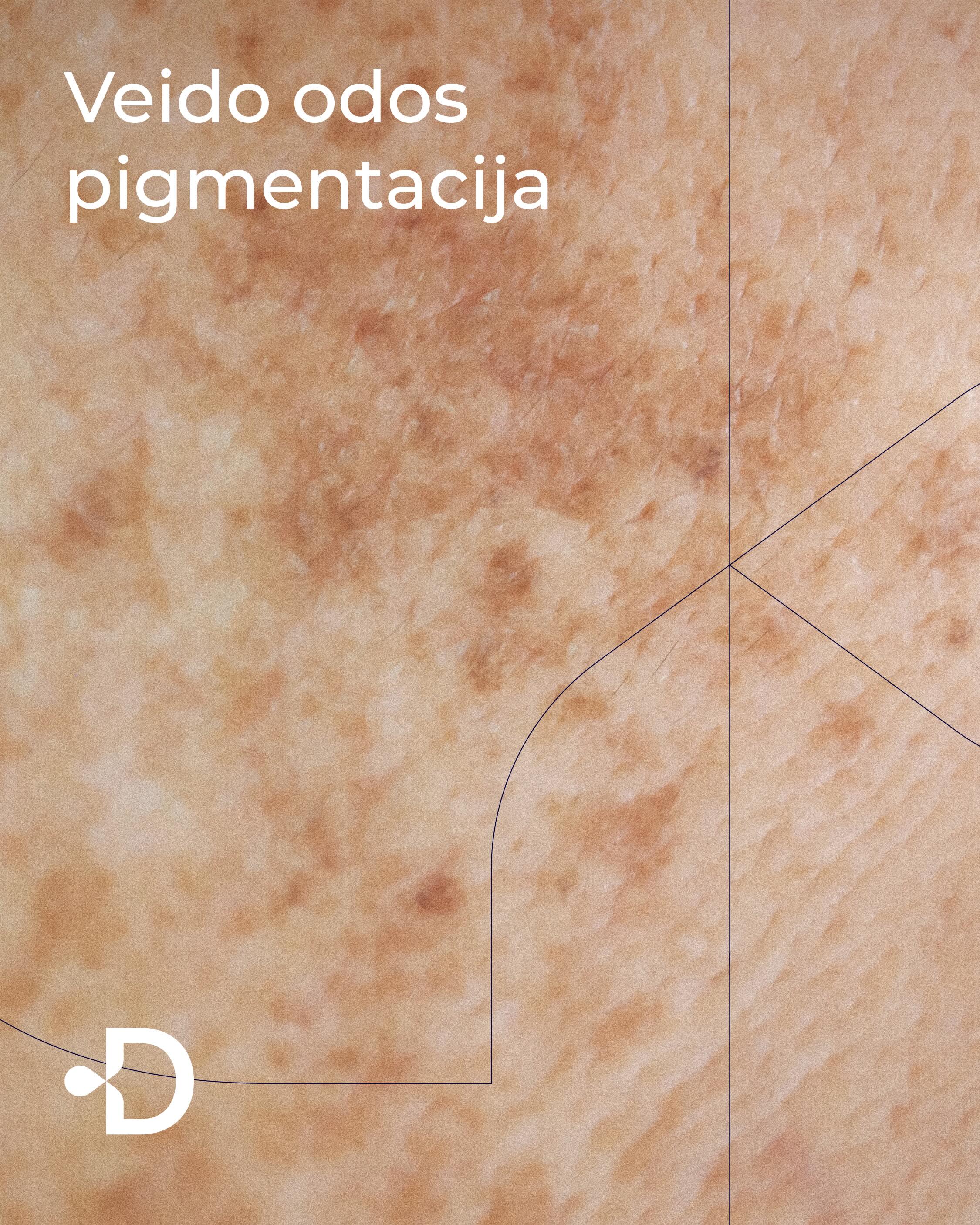 Dermateka.lt Facebook ad