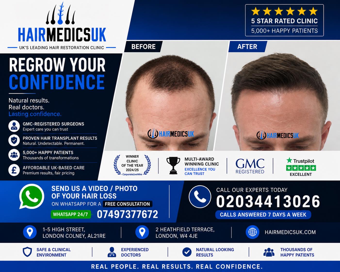 Hair Medics UK Facebook ad: Hair Medics UK | FUE Hair Transplants | Hair Loss Clinic