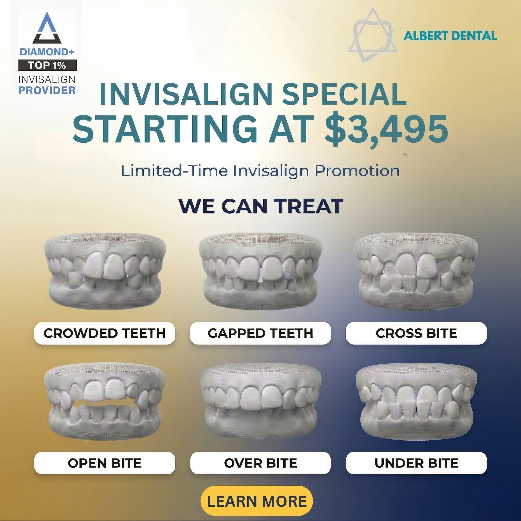 Albert Dental Facebook ad: Hey, Olathe & Overland Park! Invisalign starting At Just…