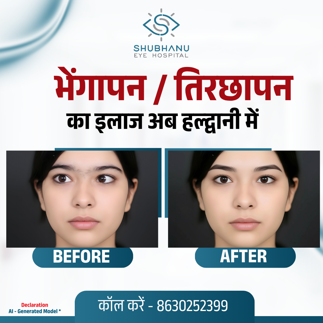 Shubhanu Eye Hospital Facebook ad