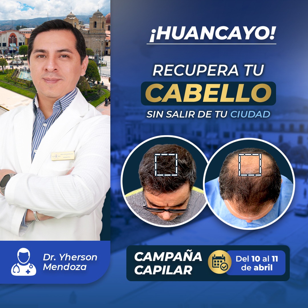 Perfection capilar - Trasplante capilar Facebook ad: VUELVE A TENER CABELLO EN HUANCAYO