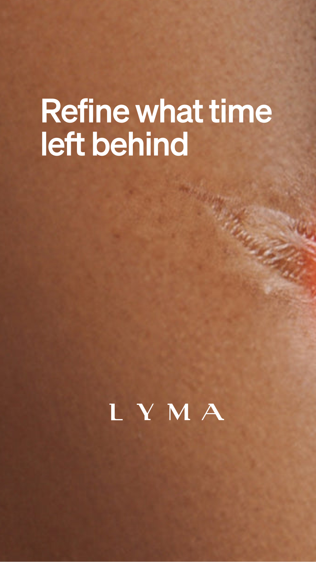 LYMA Facebook ad