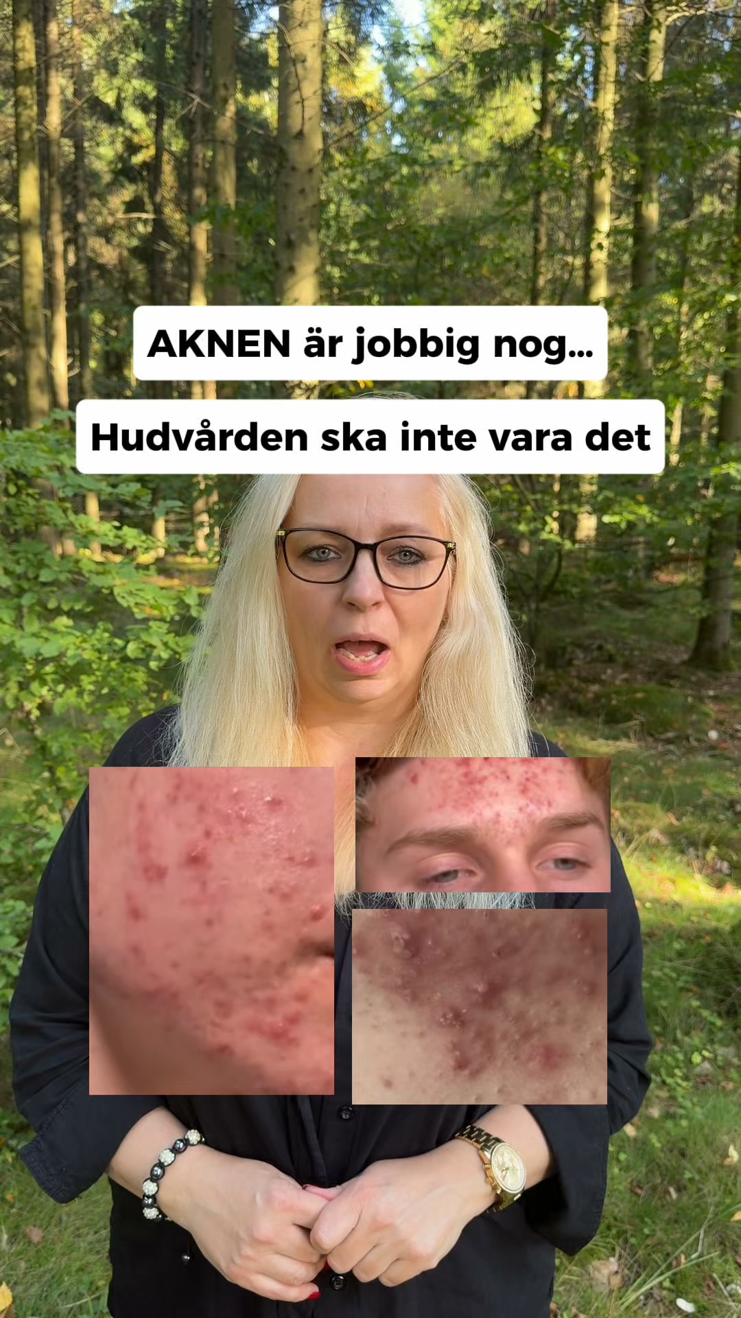LovieBaby Facebook ad: Naturlig hudvård för akne