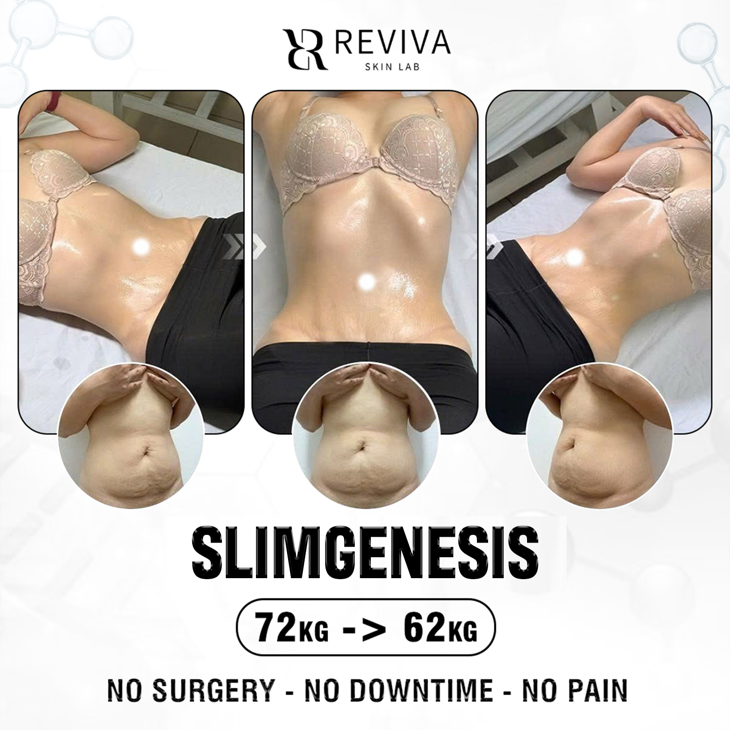 Reviva Aesthetic & Beauty Clinic - Iloilo Branch Facebook ad from Aug 8, 2026