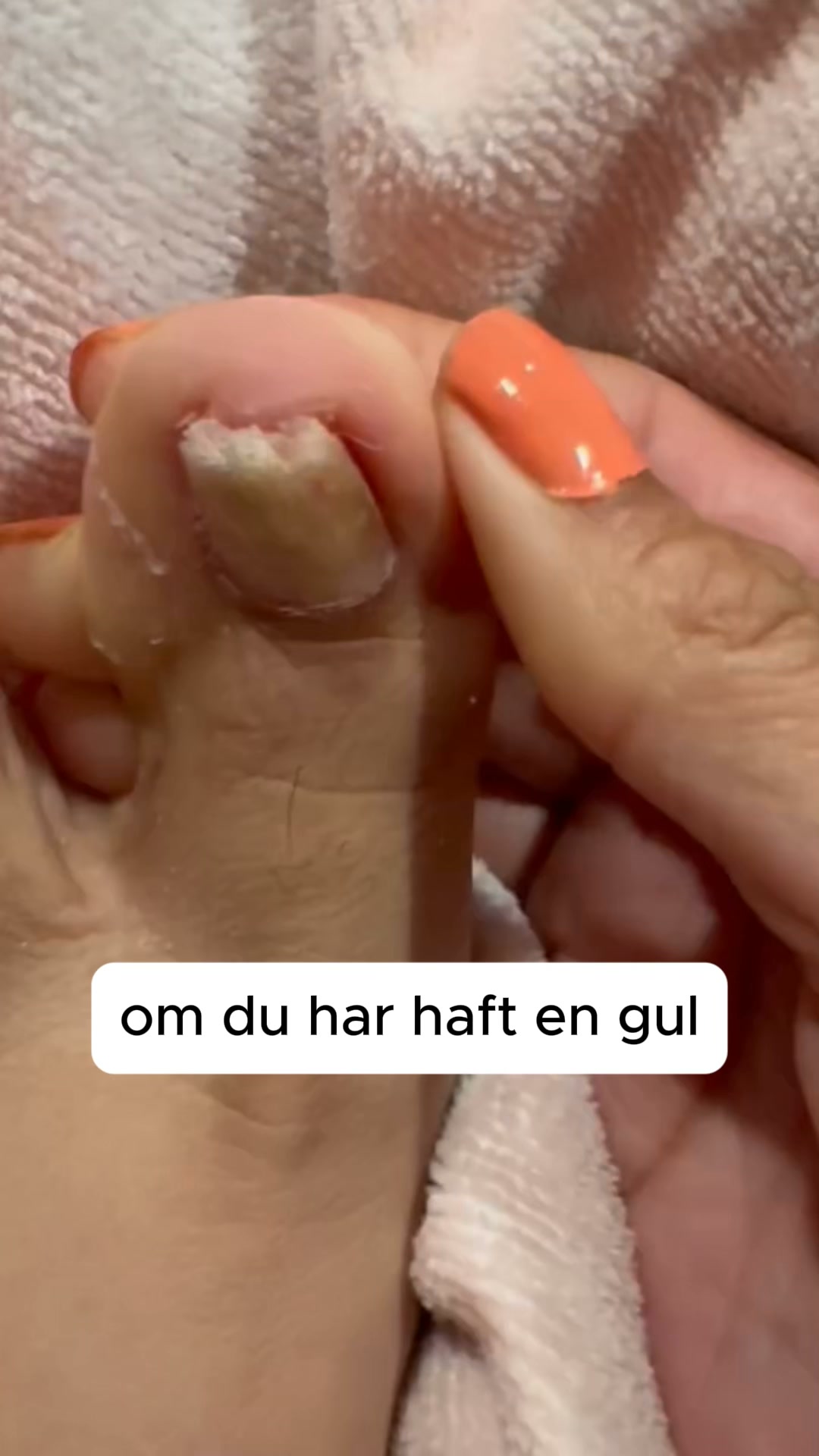 Vardagsval Facebook ad: Det enkla sättet att behandla nagelsvamp