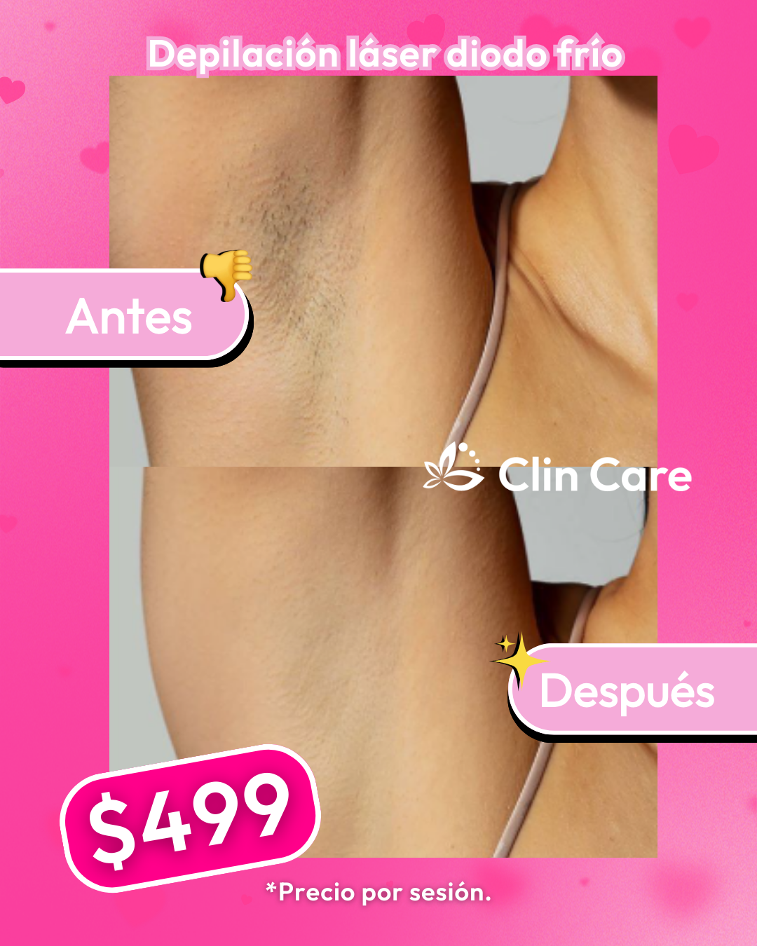 Clin Care - Depilacion laser & Med Spa Facebook ad from Jan 29, 2026
