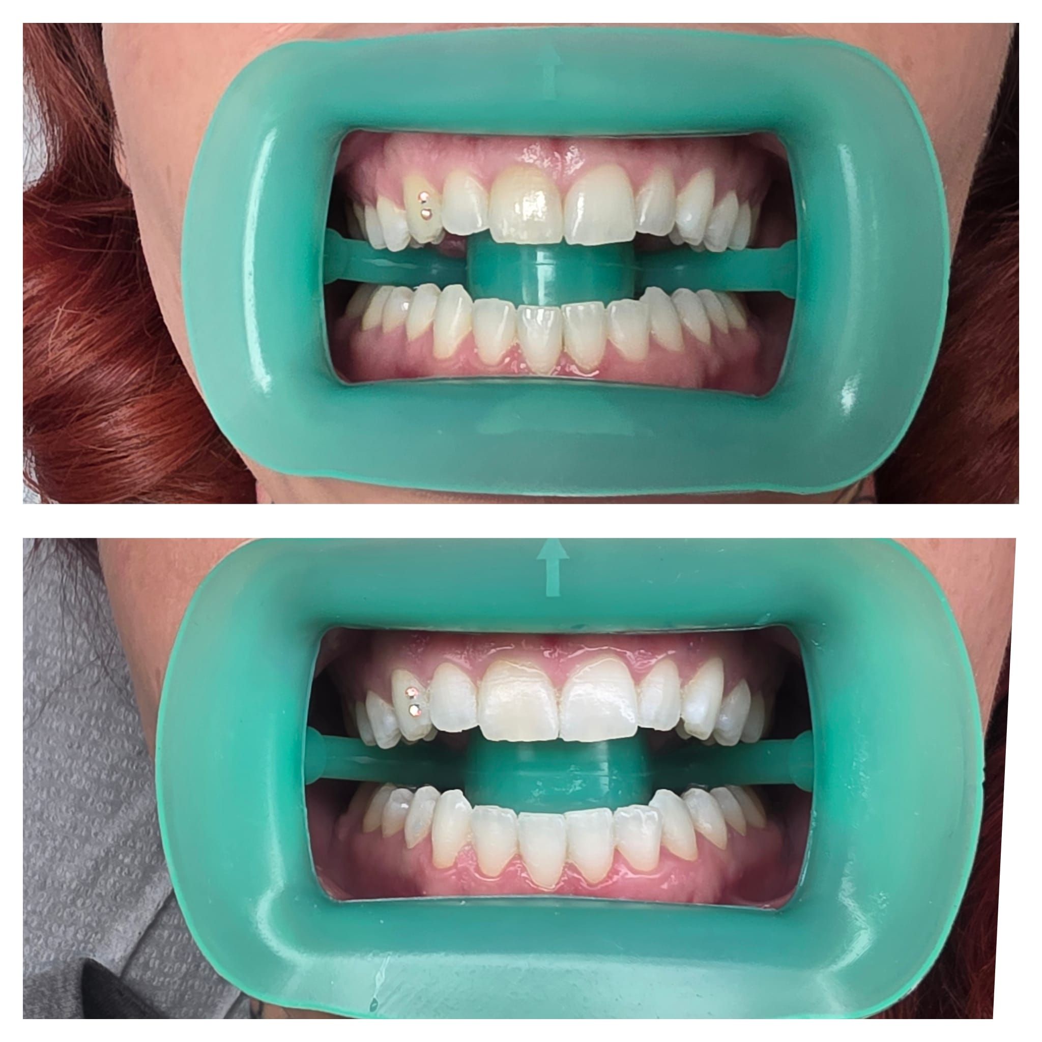 Lavish Beauty Bar Facebook ad: We’re now offering professional teeth whitening by an…
