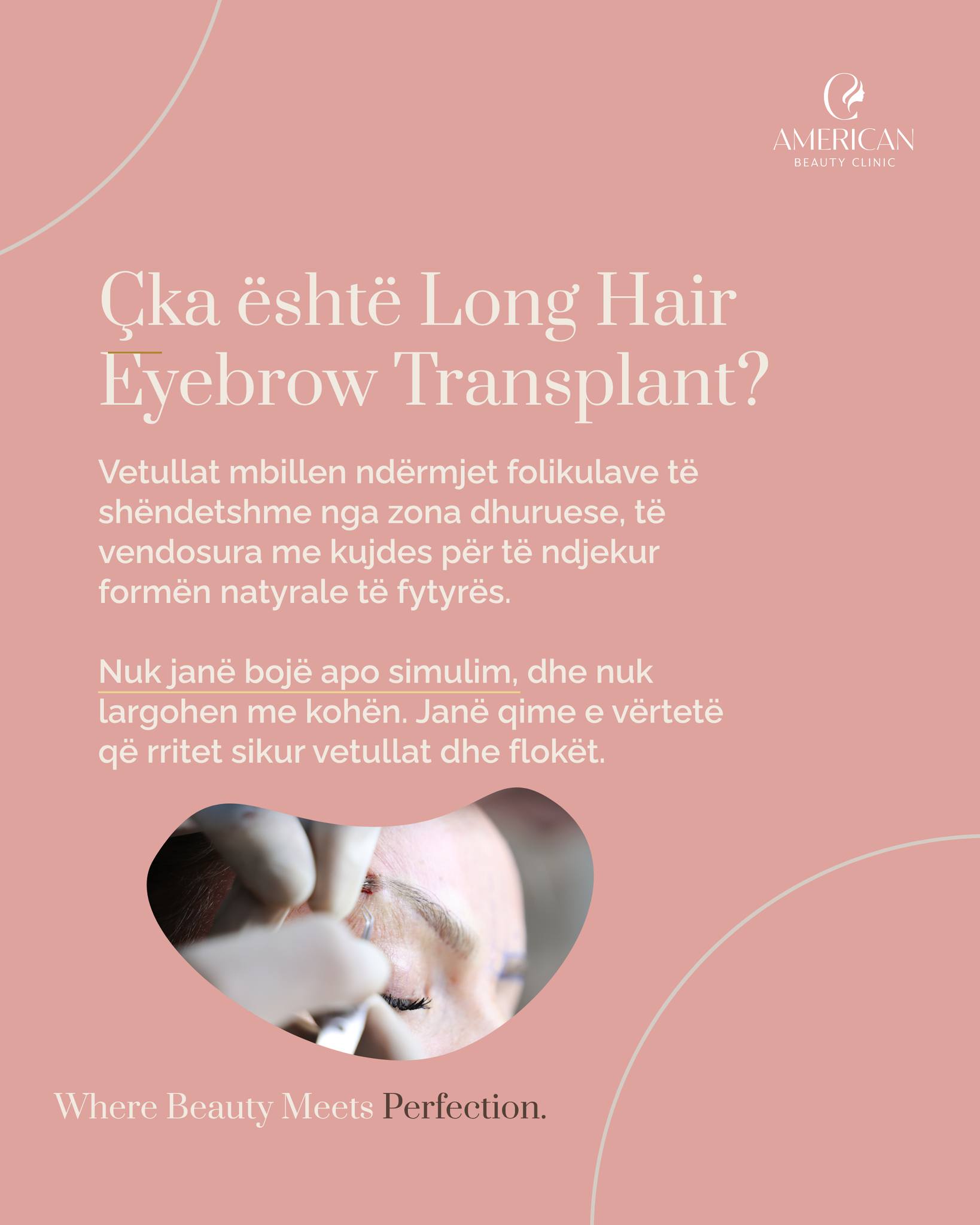 American Beauty Clinic Facebook ad: Shumë prej jush kanë pyetur për mbjelljen e…