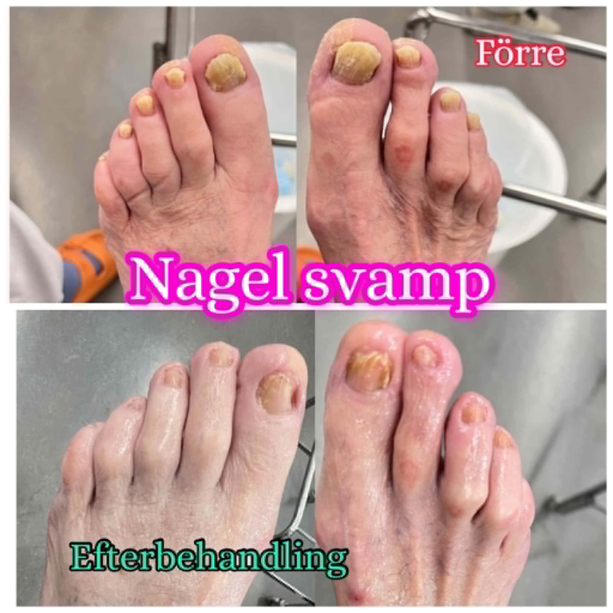 Wans Fotklinik & Skönhet Facebook ad: Höstfina fötter & sista chansen till nuvarande priser!