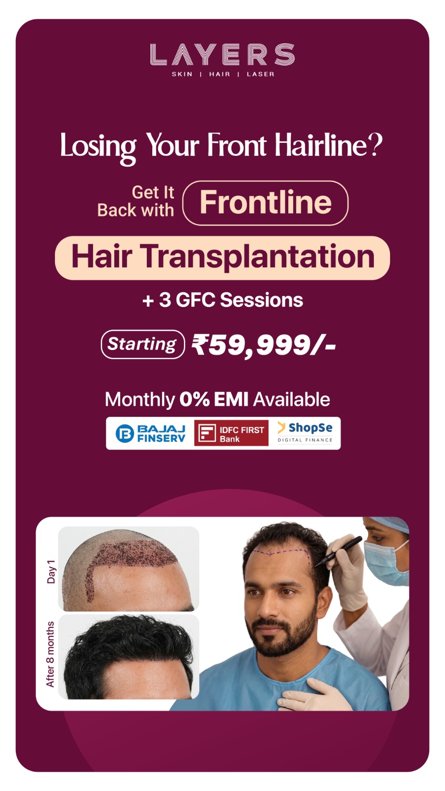 Layers Clinics - Skin & Hair Facebook ad