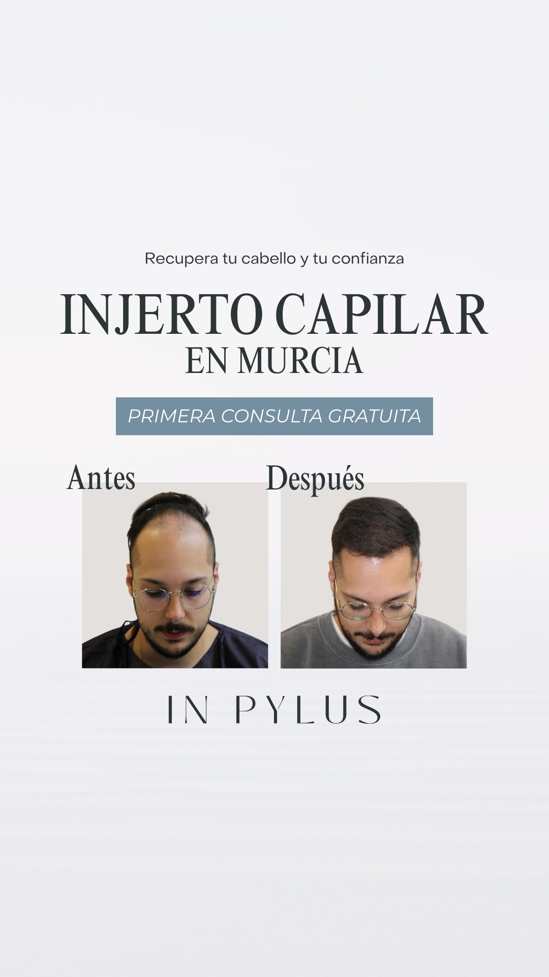 IN PYLUS - Clínica de Trasplante Capilar Facebook ad