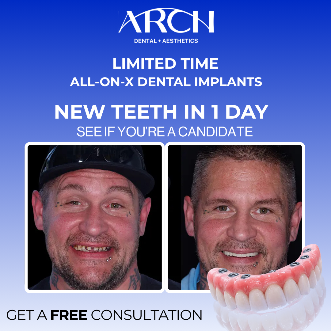 ARCH Dental + Aesthetics Facebook ad: Schedule Your Free Consultation