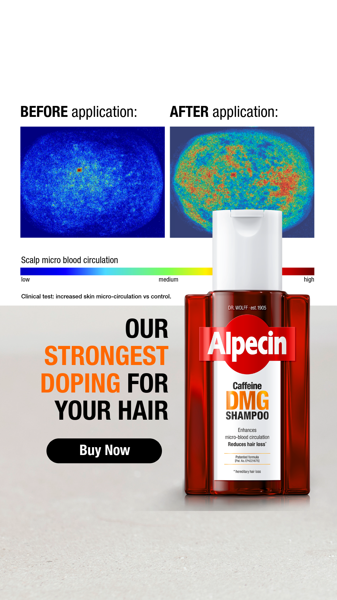 Alpecin Facebook ad