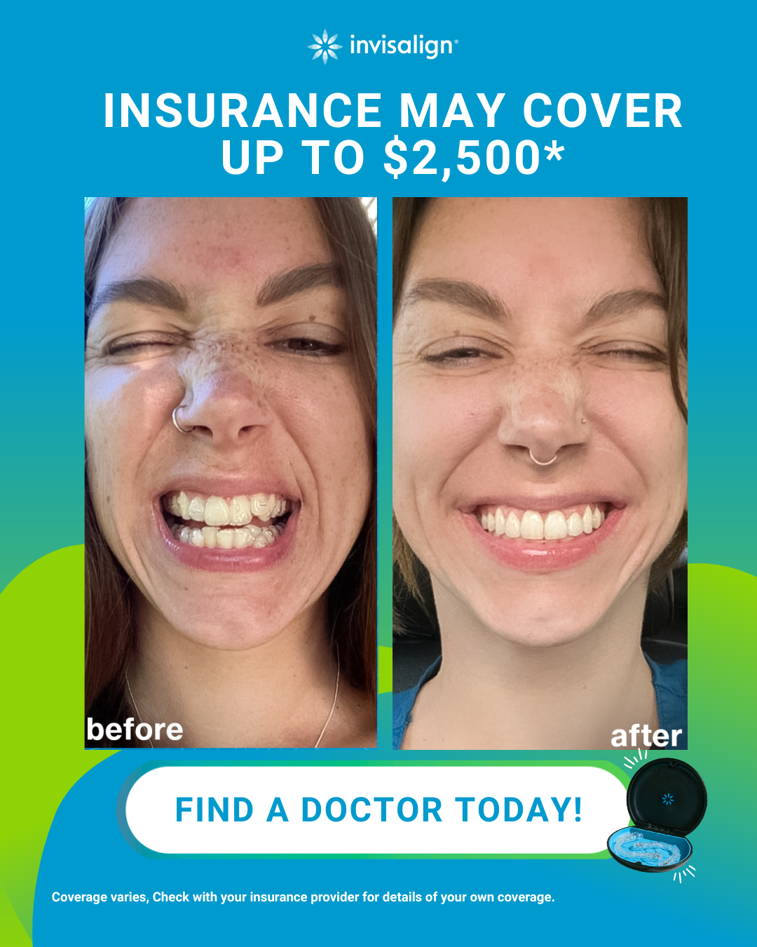 Invisalign Facebook ad
