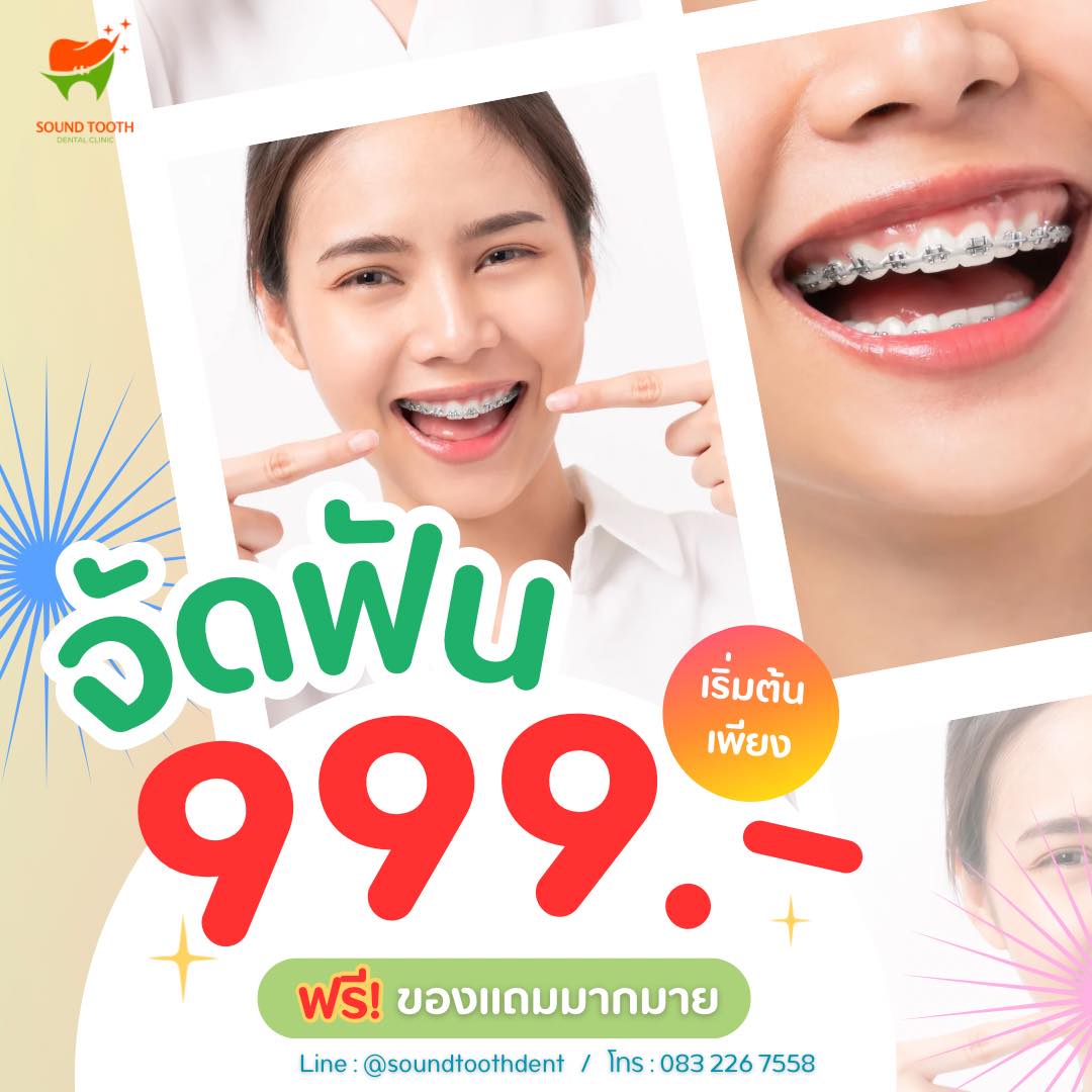 Sound Tooth Dental Clinic คลินิกทันตกรรมซาวด์ทูธ ปัตตานี Facebook ad: ประกาศข่าวดี!