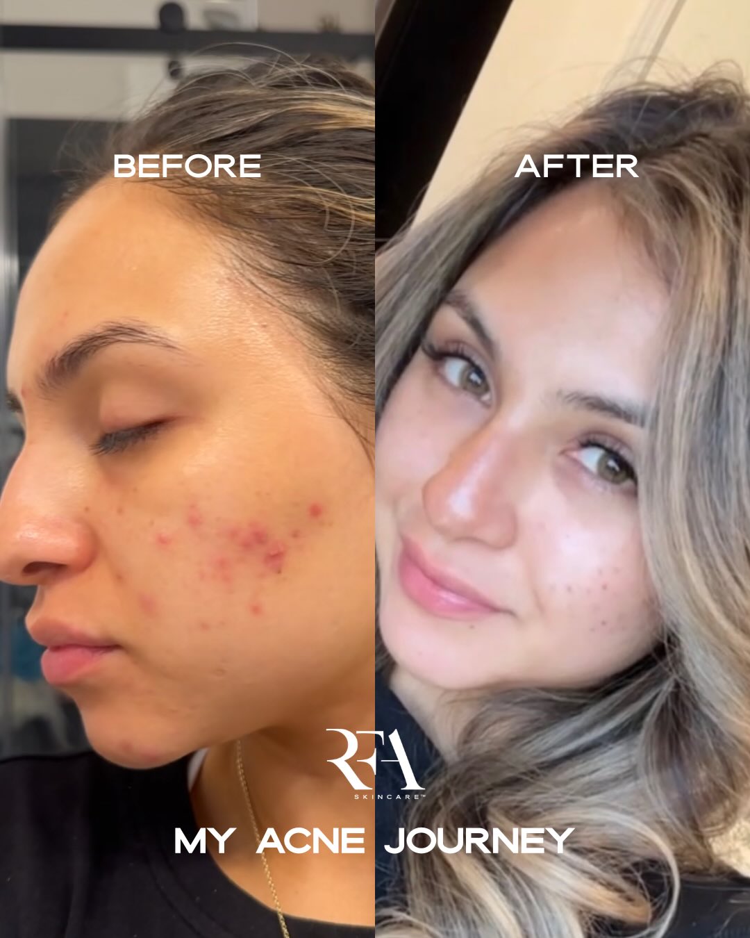 RFA Skincare Facebook ad: I feel confident and beautiful without makeup!