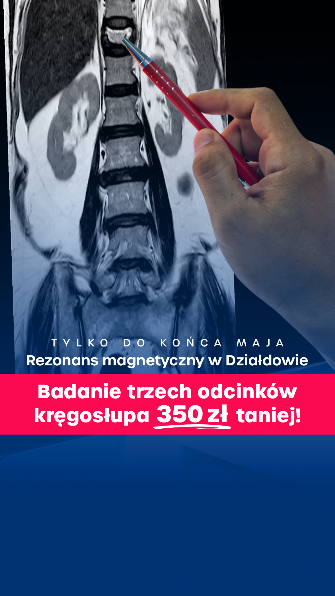 MR Diagnostic Rezonans Magnetyczny Facebook ad from May 7, 2026