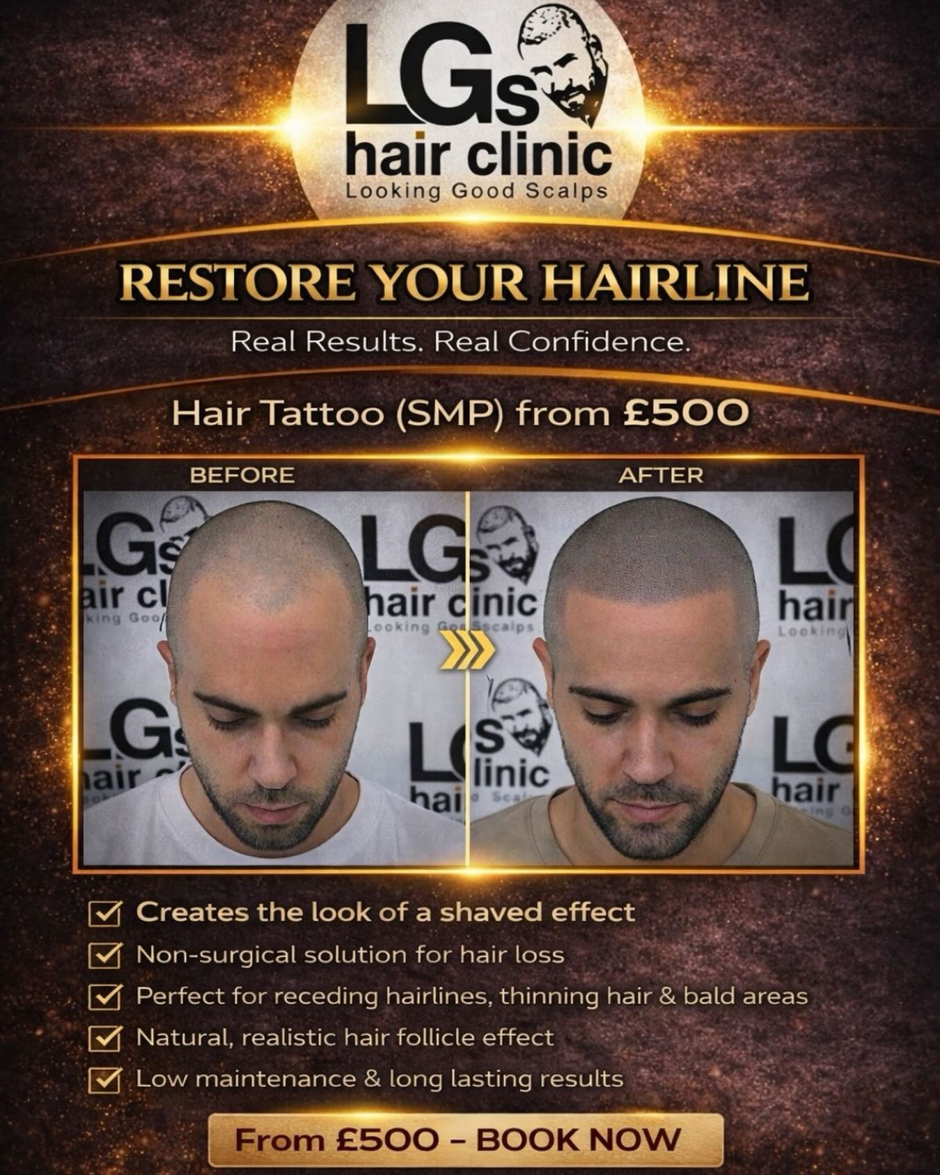 LGS Hair Clinic Facebook ad: Scalp Micropigmentation, interested in the treatment?