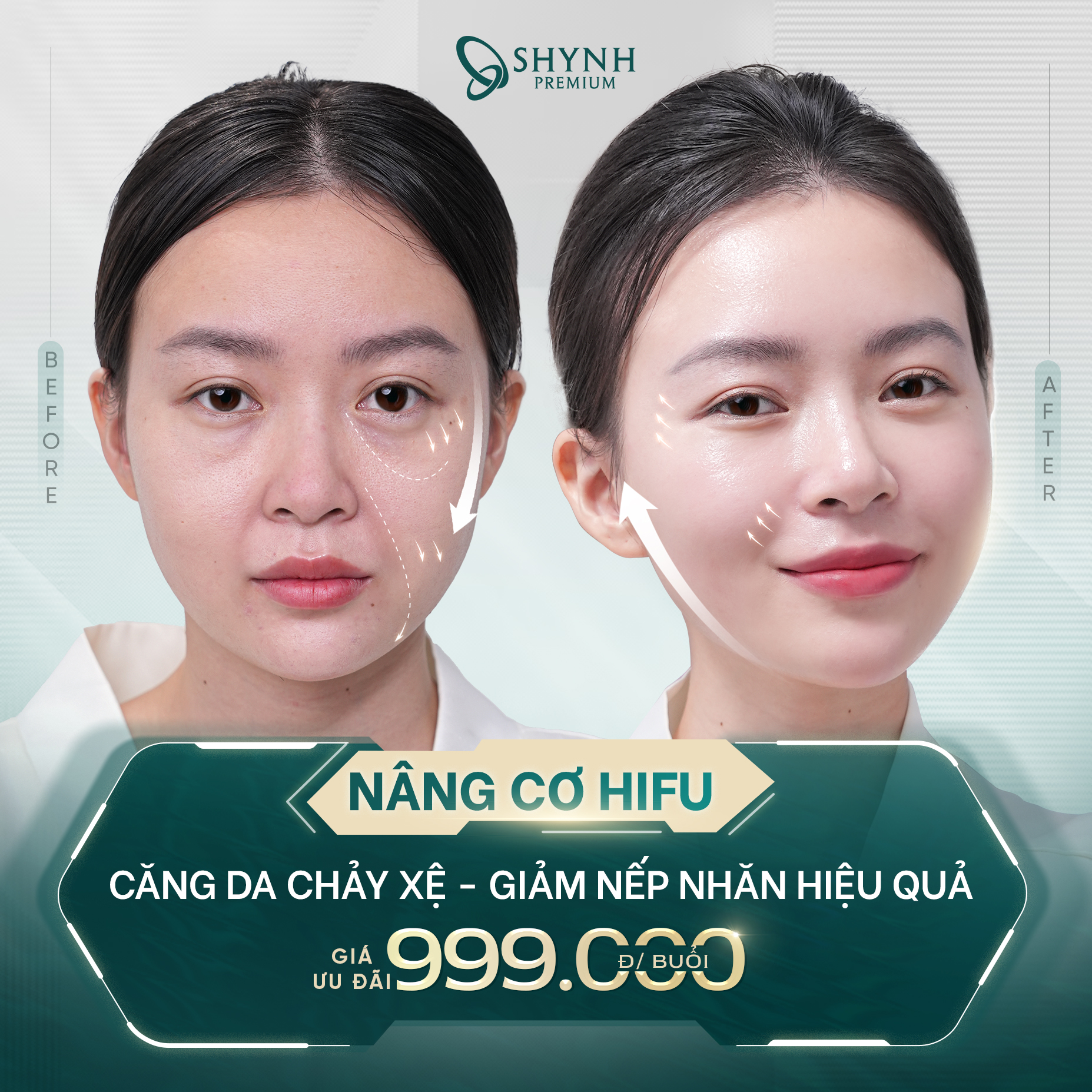 Viện Thẩm Mỹ Shynh Premium Đà Nẵng Facebook ad: 70 Phút Nâng Cơ Chỉ Với 999.000 Tại Đây >>>
