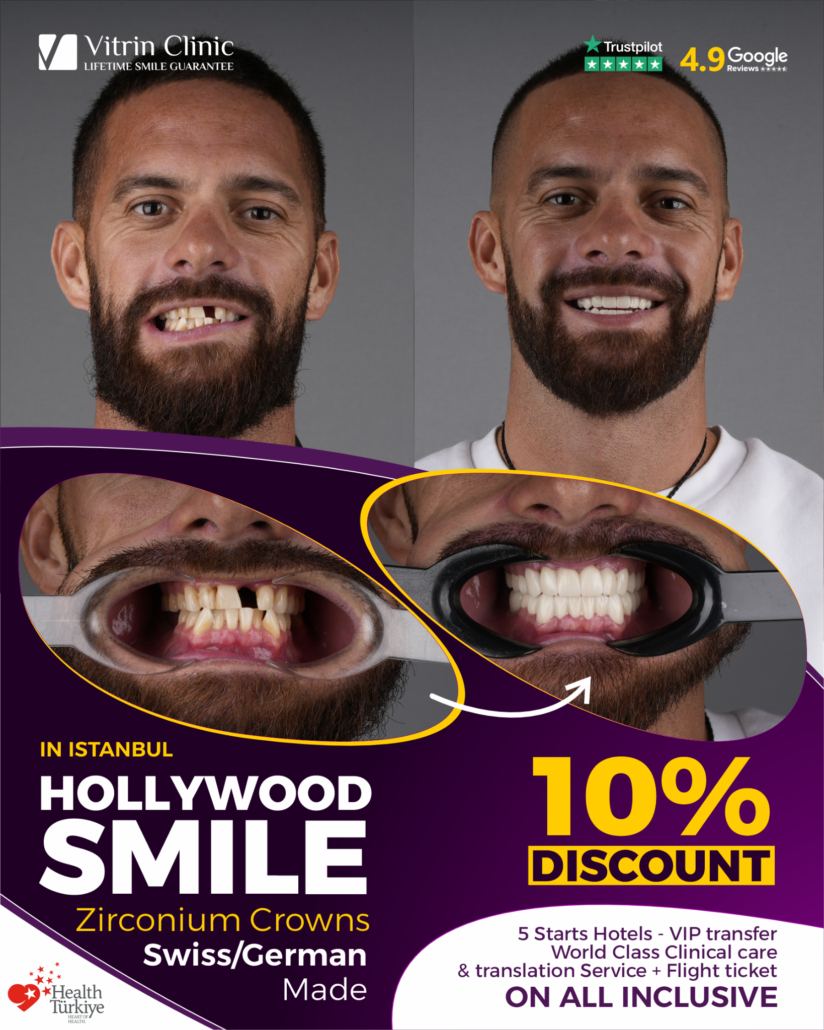 Vitrin Dental Clinic Facebook ad