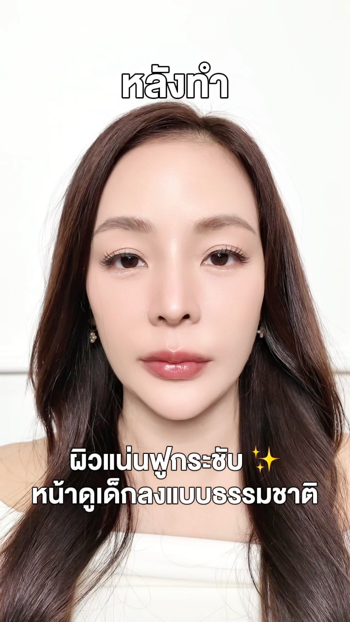Aura Bangkok Clinic Facebook ad: ใครไม่อยากหน้าแก่ก่อนวัยต้องอ่าน…