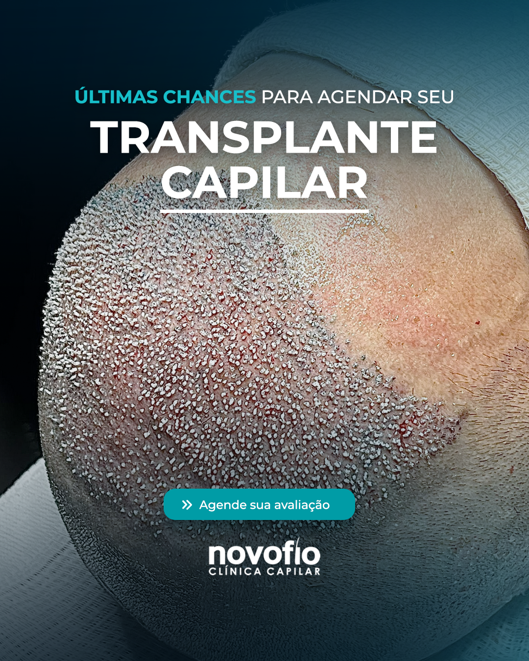 Novofio Belo Horizonte Clinica Capilar Facebook ad