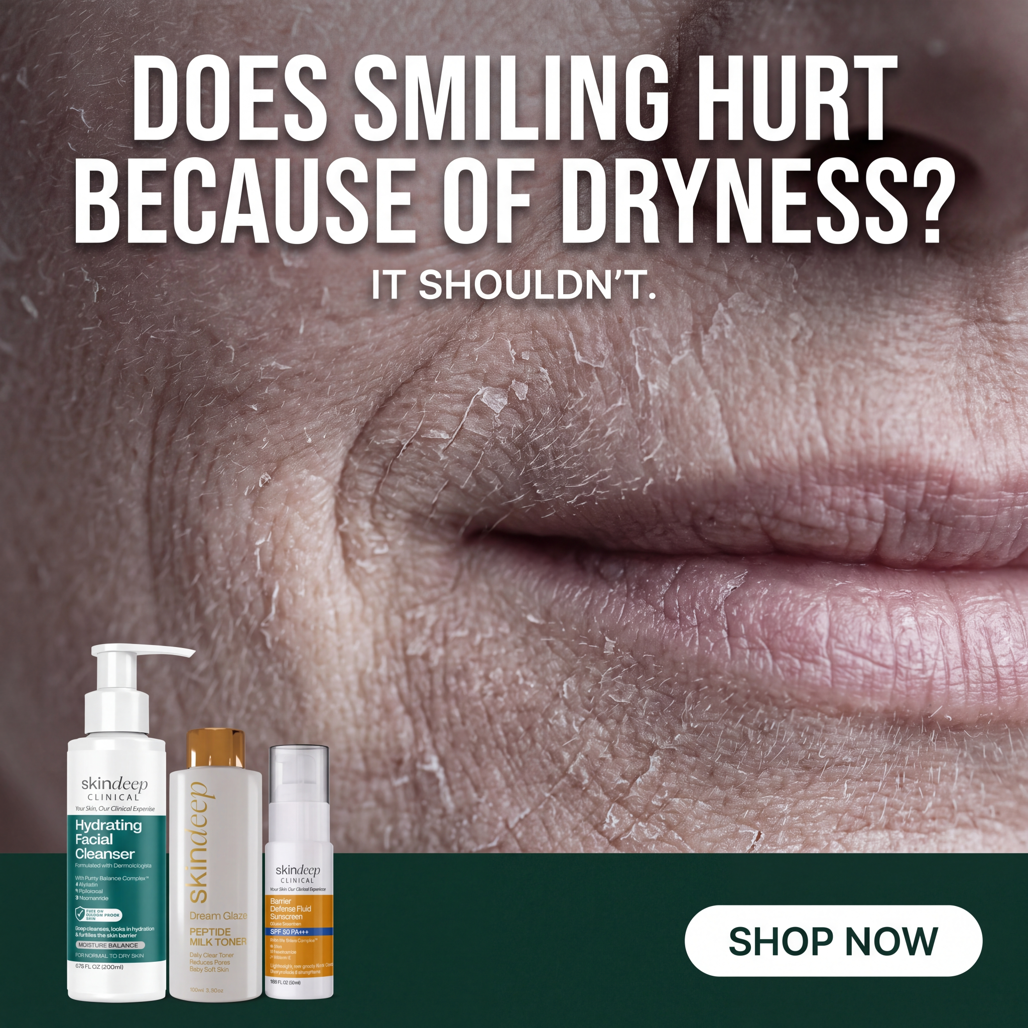 Skin Deep Facebook ad