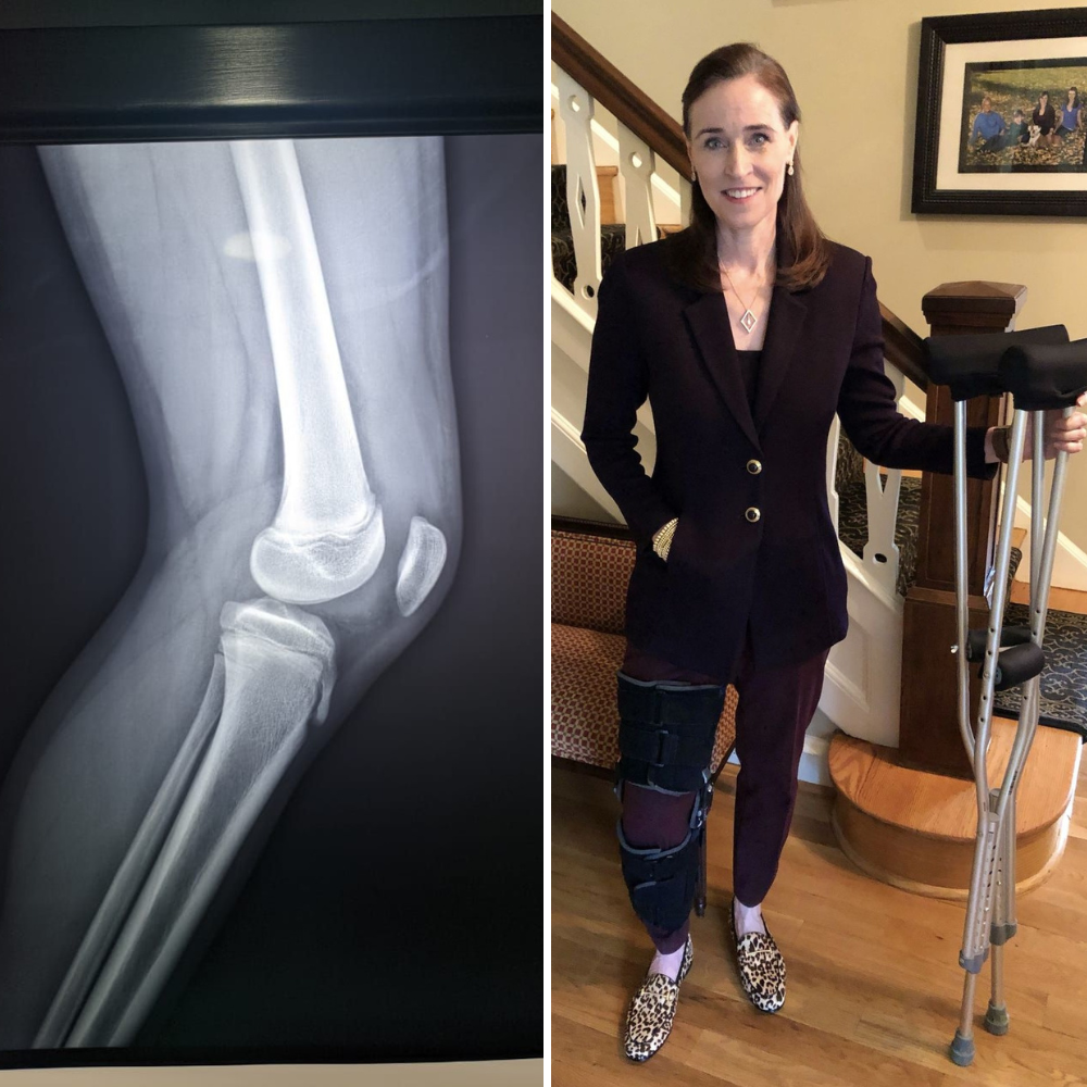 Sarah Mortenson - Knee Support Facebook ad: Read if your Knee Pain has you Depressed