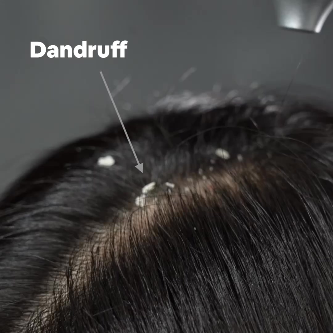 Hair Doc Facebook ad from Jul 1, 2026